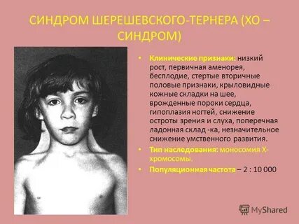 Синдром барбера сея