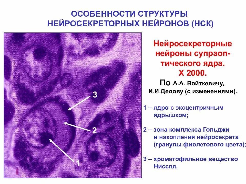Нейроны ядер гипоталамуса. Нейросекреторная клетка гистология. секреторные нейроны препарат. нейросекреторные клетки гипоталамуса гистология. гипоталамус гистология.