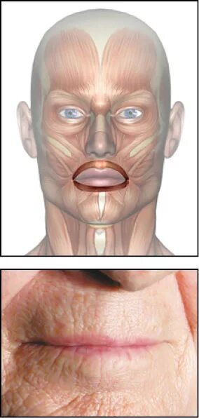 Губы мышцы рта. Спазм круговой мышцы рта. Гипертонус круговой мышцы рта.