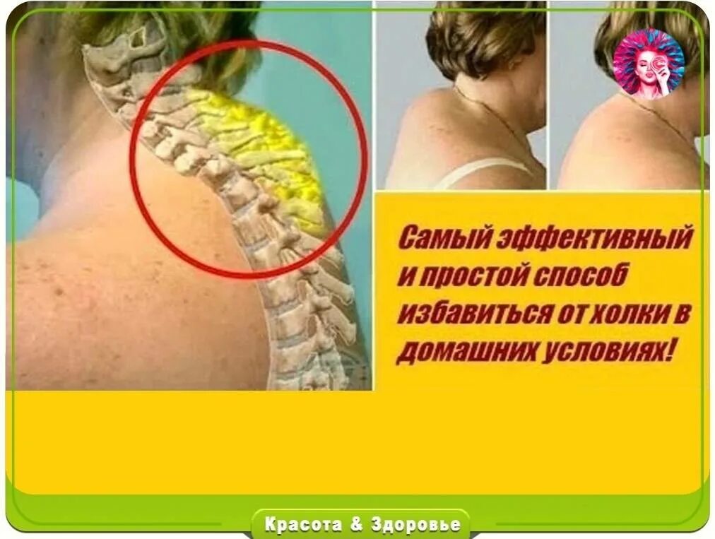 Как лечить холку. Как лечить холку