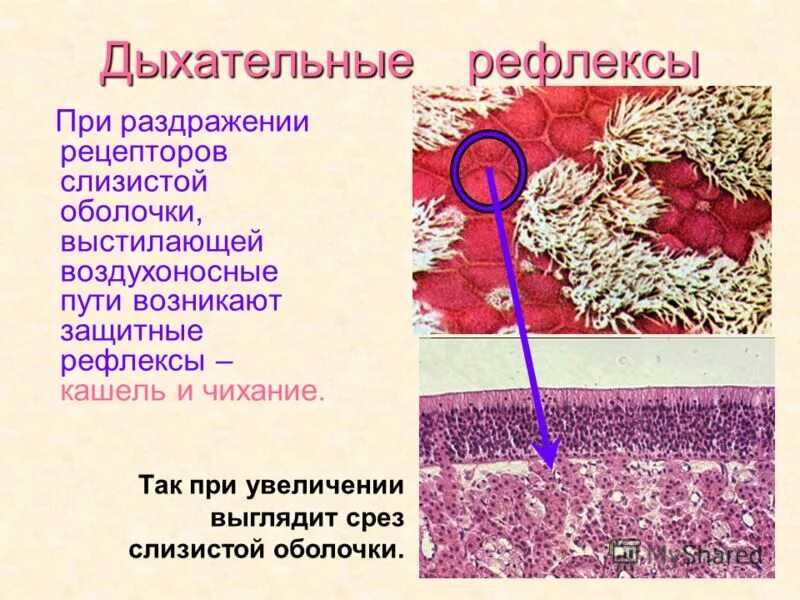 Рефлекторная регуляция дыхания. Виды стратегий скидок. Слабительные раздражающие рецепторы кишечника. Защитные дыхательные рефлексы. Муколитики механизм действия.