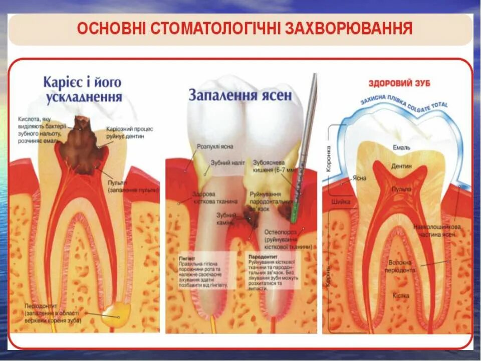 Рокс периодонт