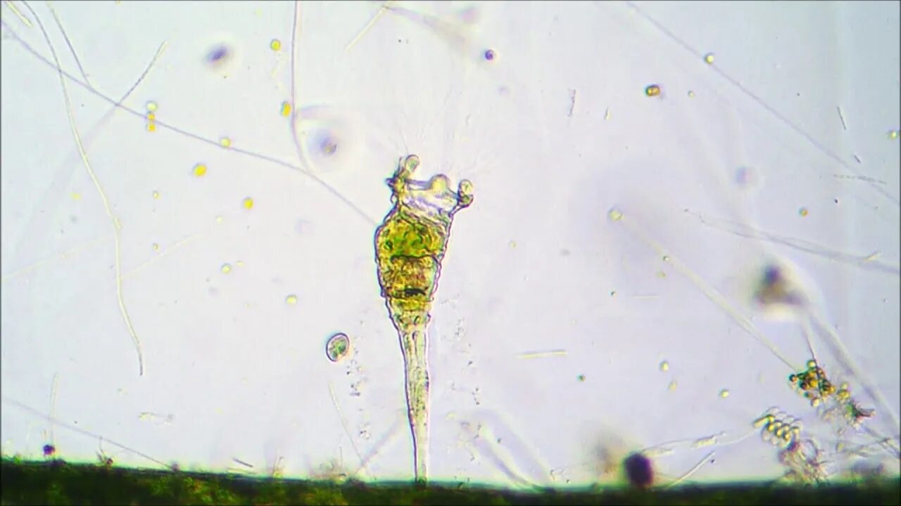 Эпифанес Коловратка. Коловратка в микроскопе. Коловратка под микроскопом. Коловратка световой микроскоп. Коловратки в экосистеме
