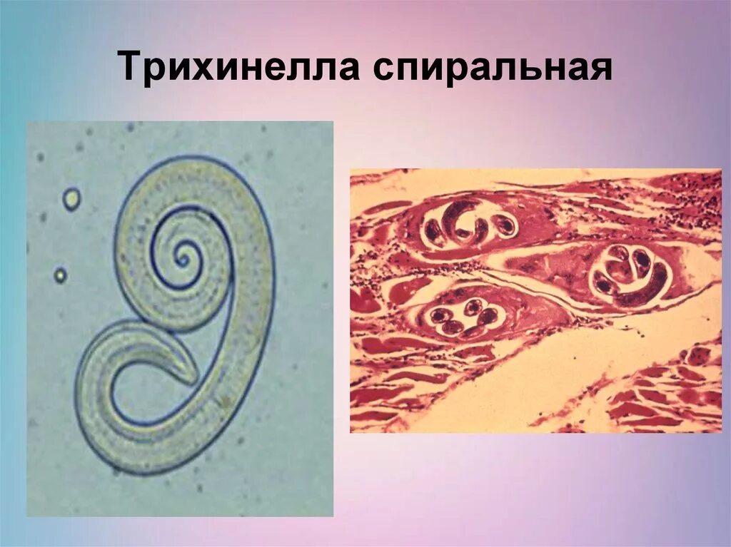 Трихинелла спиральная черви. Трихинелла спиральная препарат. Трихинелла круглые черви. Заражение трихинеллы спиральной.