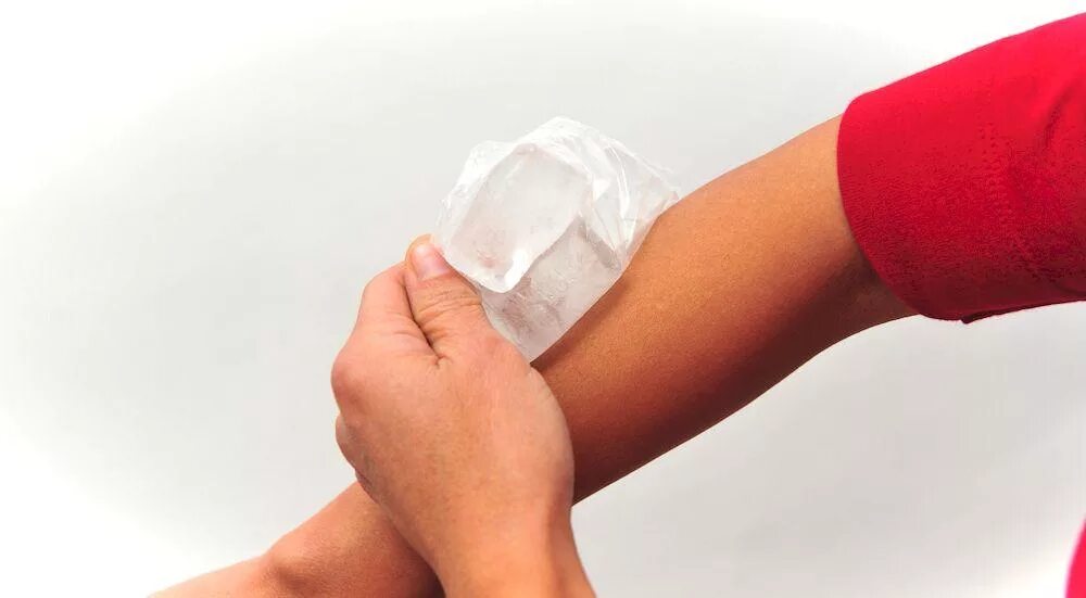 Компресс на руку при растяжении. Растяжение локтевого сустава. Компресс с капустным листом. Компресс при ушибе руки. Пузырь со льдом.