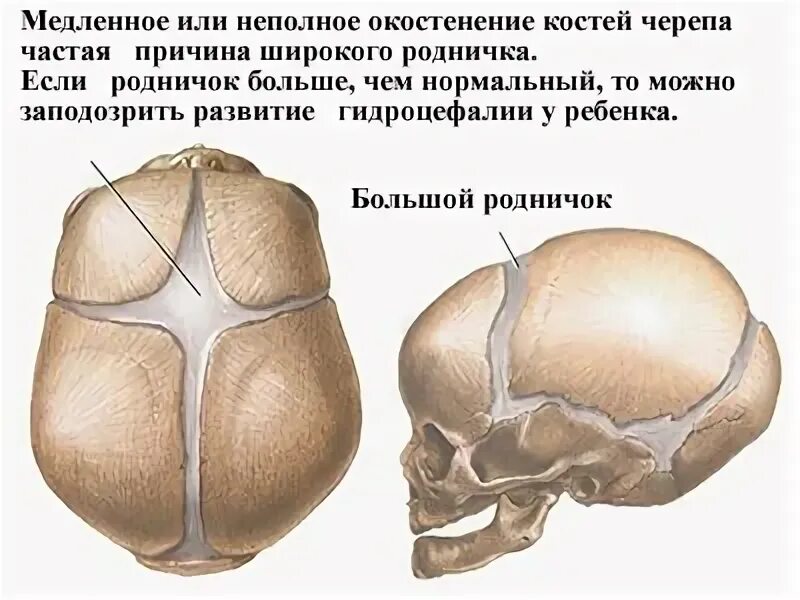 Роднички черепа зарастают к. Родничок и темечко у новорожденных. Темечко у новорожденных темечко. Форма большого родничка у новорожденных.