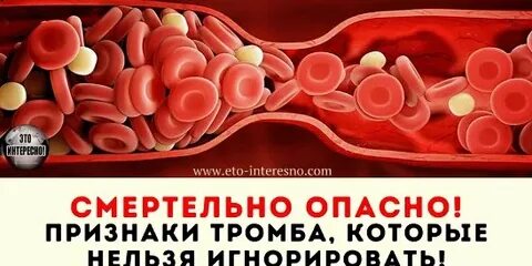 Как проверить организм на наличие тромбов