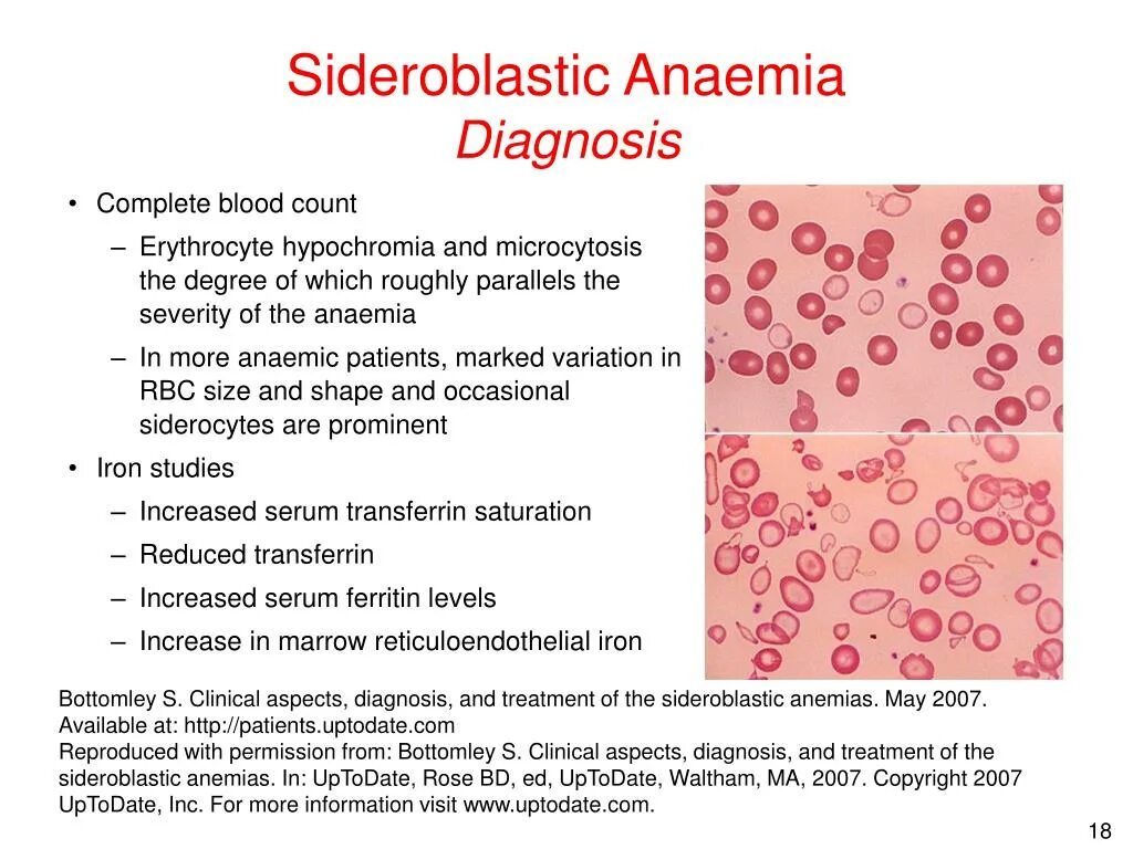 Angiectasia латынь