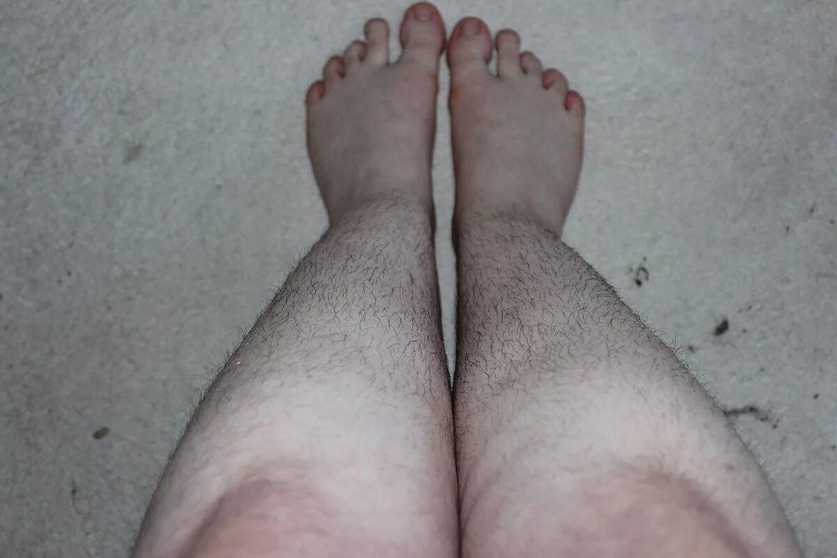 Hairy foot. Волосатые женские ножки.