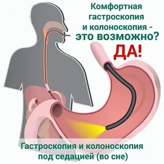 Колоноскопия в чебоксарах отзывы