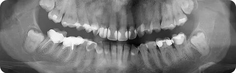 Керемет бөкселері бар әдемі жалаңаш балапандар