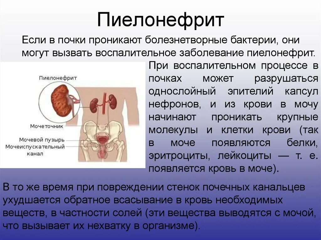 Может ли болеть одна почка. Заболевания мочевыделительной системы пиелонефрит. Патология почки. Пиелонефрит. Пиелонефрит причины заболевания.