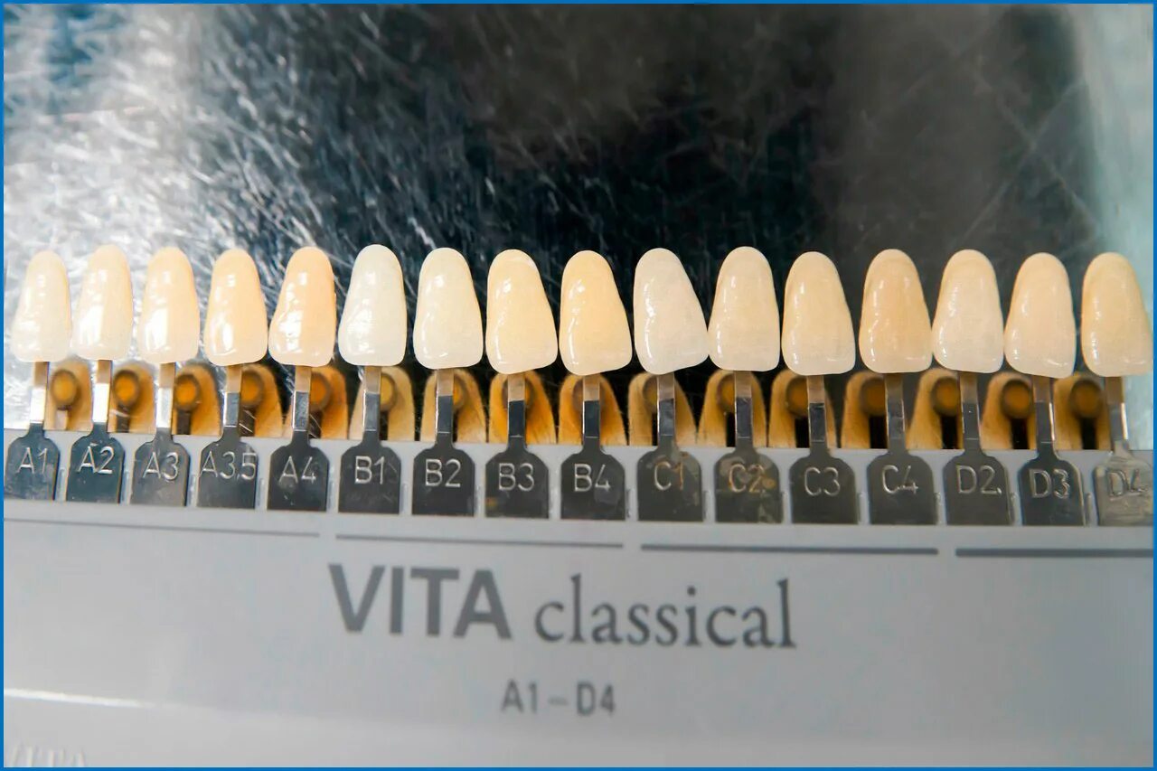 Палитра стоматология. Шкала Вита а1. Цвета виниров Emax палитра. Шкала Vita (шкала Вита, VITASCALE). Шкала Вита а1 виниры.
