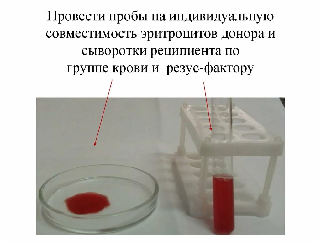 Проба на совместимость по резус фактору