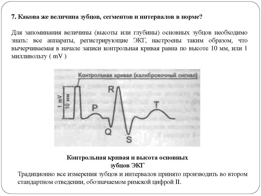 Зубцы сегменты интервалы ЭКГ. Величина зубцов и интервалов на ЭКГ. Электрокардиограмма зубцы сегменты интервалы. Нормы зубцов интервалов и сегментов на ЭКГ. Низкоамплитудная экг что это значит