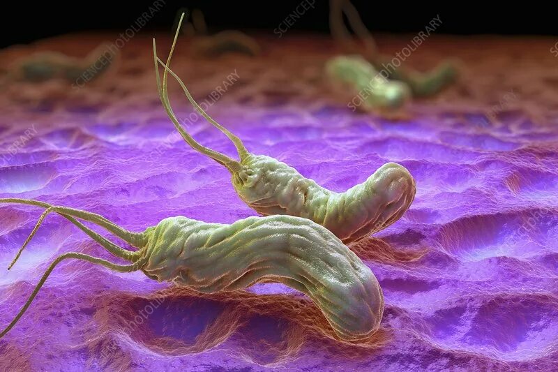 Хеликобактер фото под микроскопом как выглядит пилори Significance Of Dormant Forms Of Helicobacter Pylori In Ulcerogenesis BCD