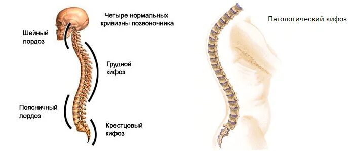 Изгиб позвоночника 6. Лордоз грудного отдела кифоз поясничного. Кифоз лордоз грудного отдела позвоночника. Отделы позвоночника лордоз кифоз. Кифоз лордоз сколиоз грудного отдела позвоночника.