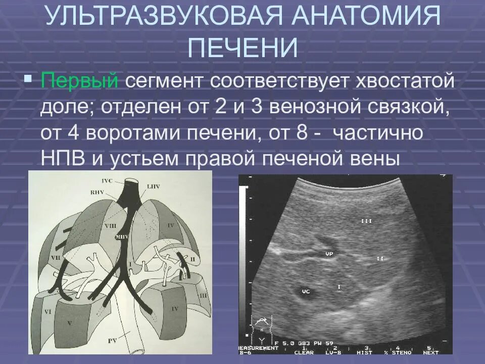 Сегменты печени печени на УЗИ. Печень на УЗИ НПВ. Ультразвуковая анатомия печени сегменты. Сегменты левой доли печени на УЗИ.