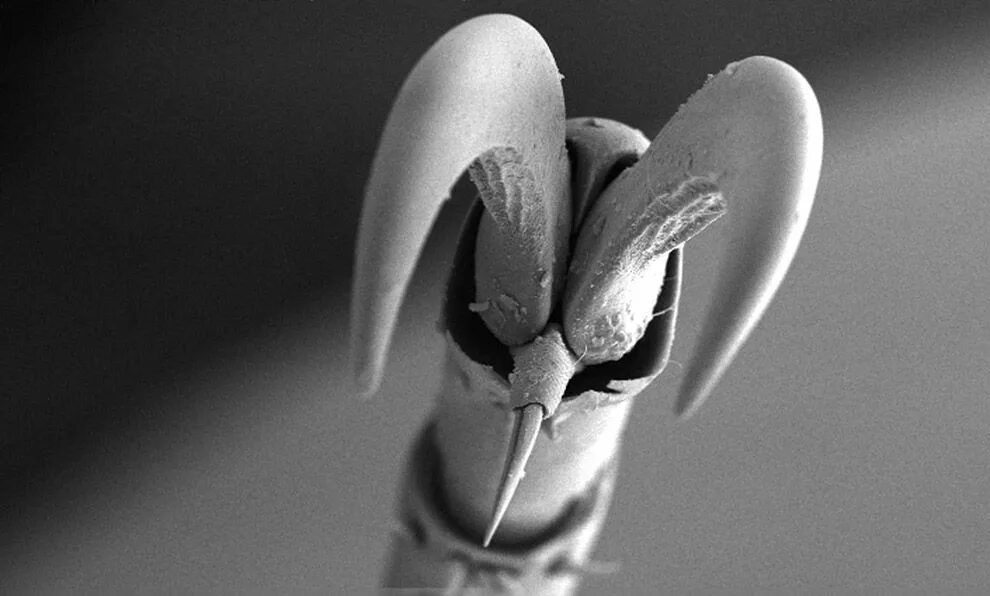 Peered into. Лапа насекомого под микроскопом. Лапка жука под микроскопом. Лапка мухи под микроскопом. Нога насекомого под микроскопом.