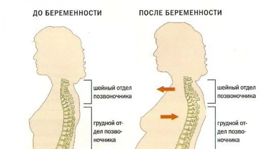 Вторая беременность болит поясница. Болит поясница при беременности. Спина при беременности. Позвоночник беременной женщины. Болит позвоночник у беременной.