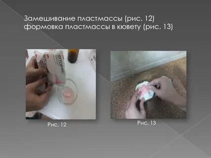 Стадии пластмассы