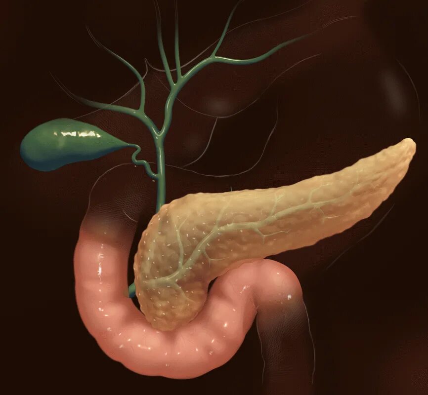 Полностью вылечил панкреатит. Поджелудочная железа pancreas.