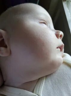 Аллергия на козье молоко