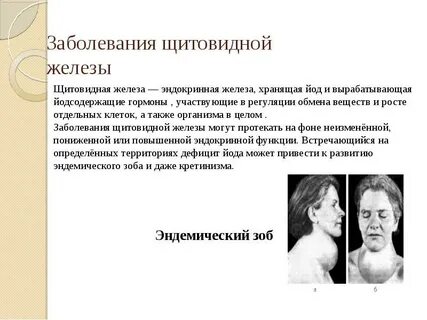 Последствия щитовидной у женщин