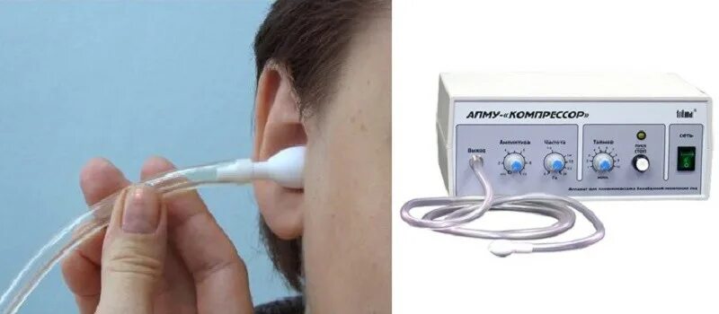 Диагноз по ушной раковине. Отовент своими руками чертеж. Акупунктура при тугоухости. Массаж ушных раковин. Массаж при отите.