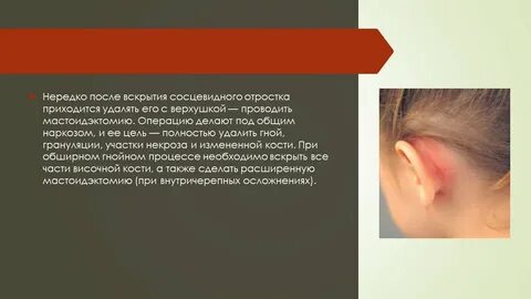 Воспаление височно