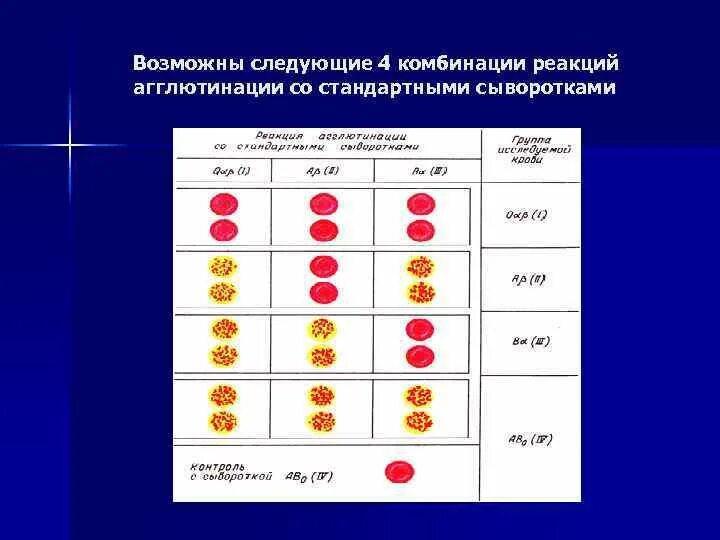 Таблица группы крови и резус фактора агглютинация. Определение группы крови агглютинация таблица. Реакция агглютинации резус фактор. Группа крови, резус фактор агглютинации.