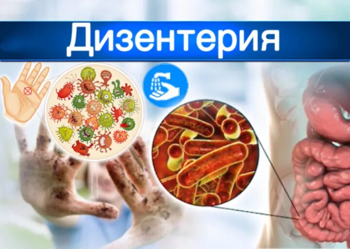 Инфекционная дизентерия. Дизентерия это инфекционное. Дизентерия характеристика. Дизентерия возбудитель инфекции. Шигеллез источник инфекции пути передачи.