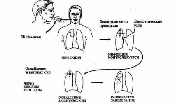 Путь заражения медперсонала туберкулезом