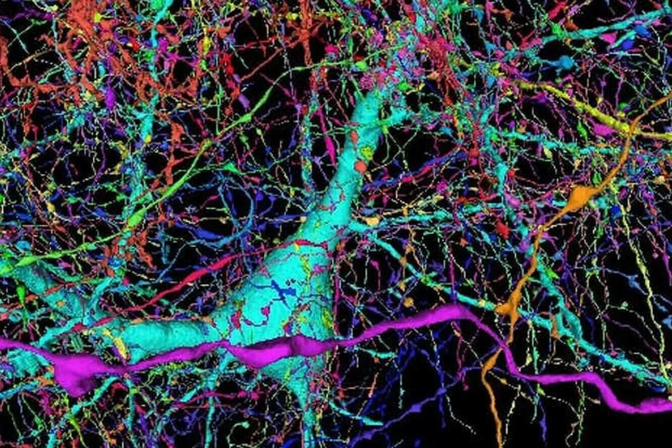 Основные клетки мозга. Нейроны мозга. Нейронная сеть мозга. Нейроны человеческого мозга. Мозг под микроскопом.