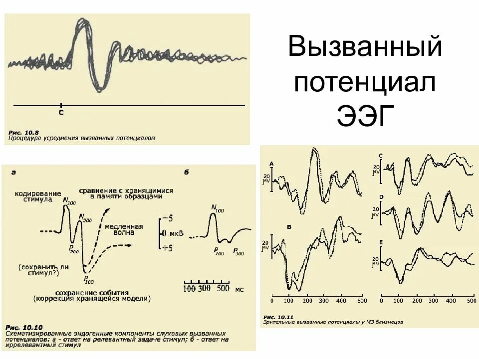 Потенциал ээг. Вызванные потенциалы. Компоненты ВП.. Метод вызванных потенциалов физиология. Вызванный потенциал в составе ЭЭГ. (Электроэнцефалограмма, вызванные потенциалы).