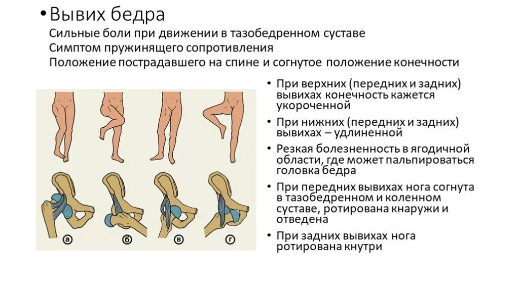 Травма правого бедра. Антеторсия тазобедренных суставов. Вывих тазобедренного сустава классификация. Характерные симптомы травматического вывиха бедра.