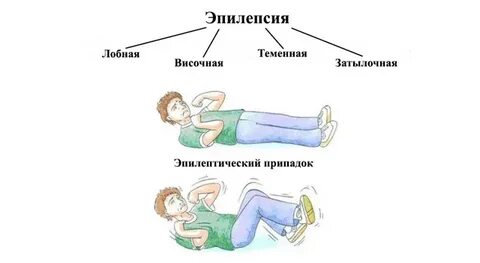 Эпилепсия без эпилепсии