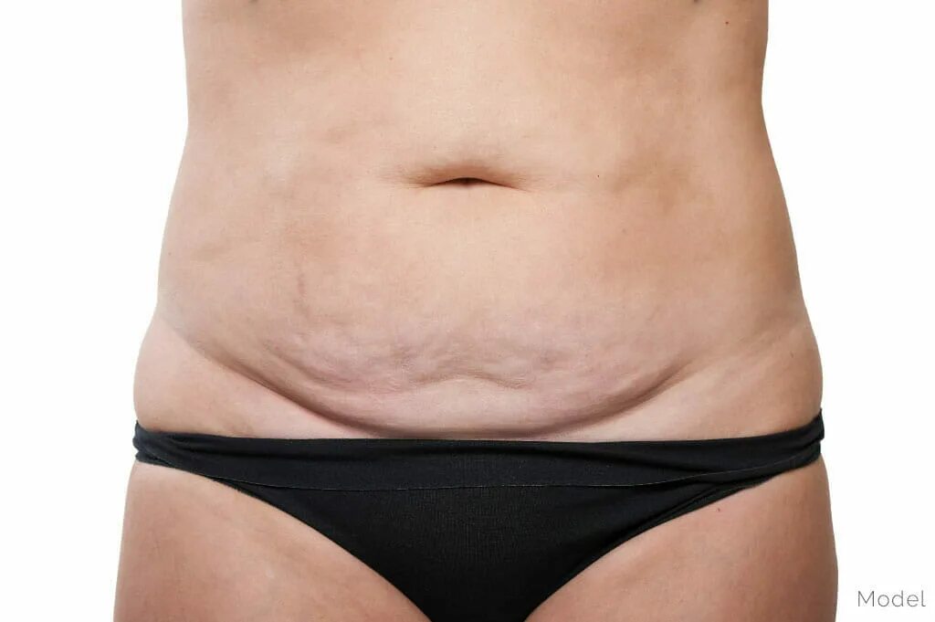 вздутие живота у женщин после 40. повышенный метеоризм, газообразование в кишечнике. вздутие живота у женщин после 40. вздутие кишечника и газообразование причины. вздутие живота у женщин после 40.