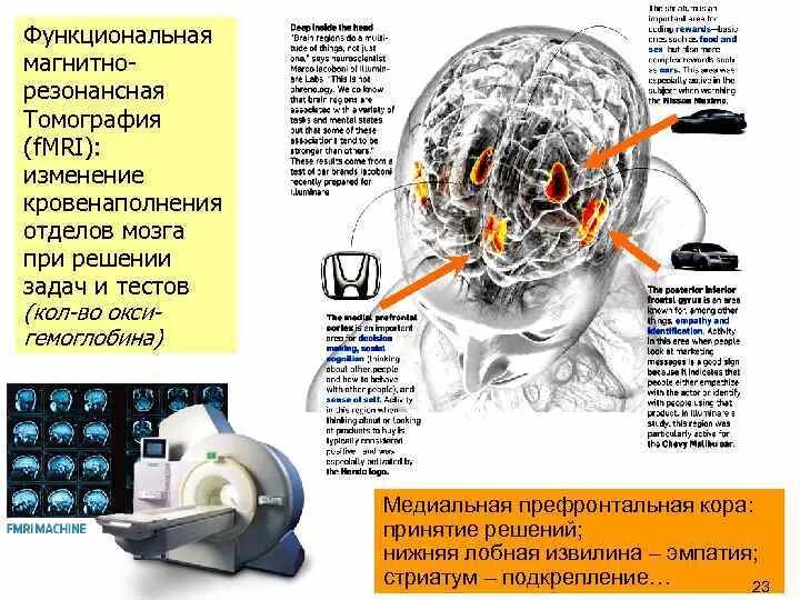 Решение brain. Мозг и принятие решений. Центр принятия решений в мозге. Участок мозга принятия решений. Отделы мозга и принятие решений.