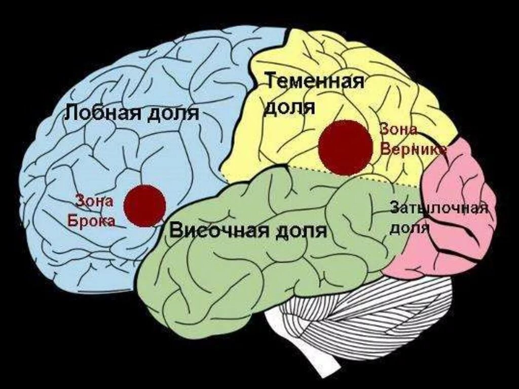 Теменная область поражения. Зона Брока и Вернике. Мозг зоны Брока и Вернике. Речевые центры. Зона Брока. Зона Вернике.