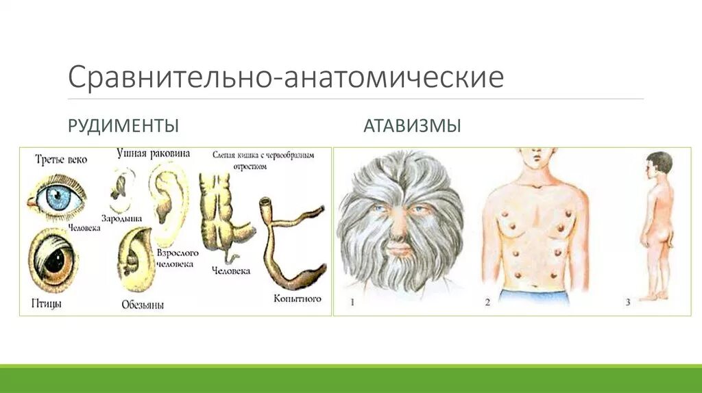 Аппендикс является рудиментом. Рудименты человека атавизмы человека. Рудименты и атавизмы таблица. Рудименты и атавизмы человека таблица. Рудименты и атавизмы схема.