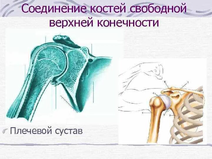 Соединения костей плечевого пояса. Соединение костей свободной верхней конечности. Соединение костей верхней конечности плечевой сустав. Блоковидные суставы верхней конечности. Тип соединения костей плечевого сустава.