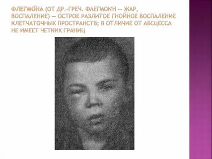 Флегмона новорожденных