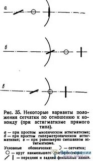 Астигматизм на 1 глазу