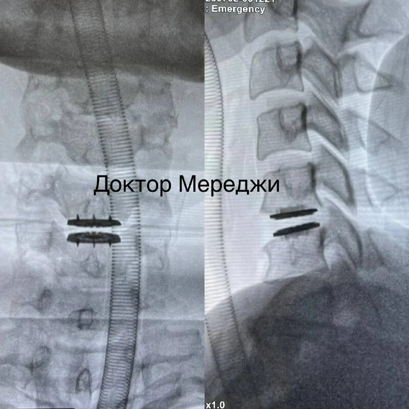 Амир муратович нейрохирург. Амир муратович нейрохирург