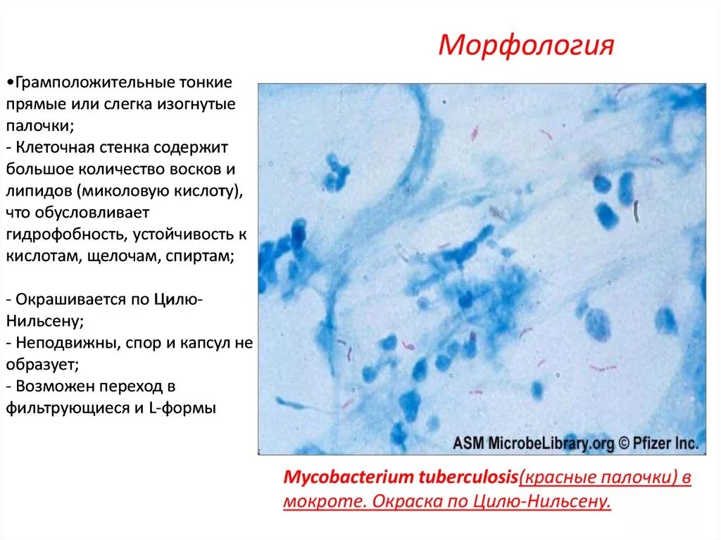 Туберкулез циль нильсену. Микобактерии Циль Нильсен. Палочки туберкулеза по Циль Нильсену. Микобактерия туберкулеза по Цилю Нильсену. Микобактерии туберкулеза в мокроте окраска по Цилю Нильсену.