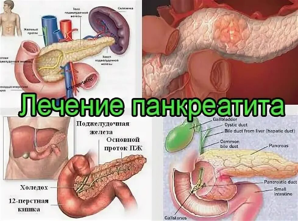 Болит поджелудочной какие таблетки. Панкреатит поджелудочной железы. Терапия панкреатита.