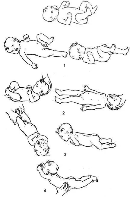 Врожденные рефлексы новорожденных. Лабиринтный тонический рефлекс новорожденного. Шейно-тонический рефлекс новорожденного. Позотонические рефлексы новорожденных. Рефлексы ребенка новорожденного позотонические.