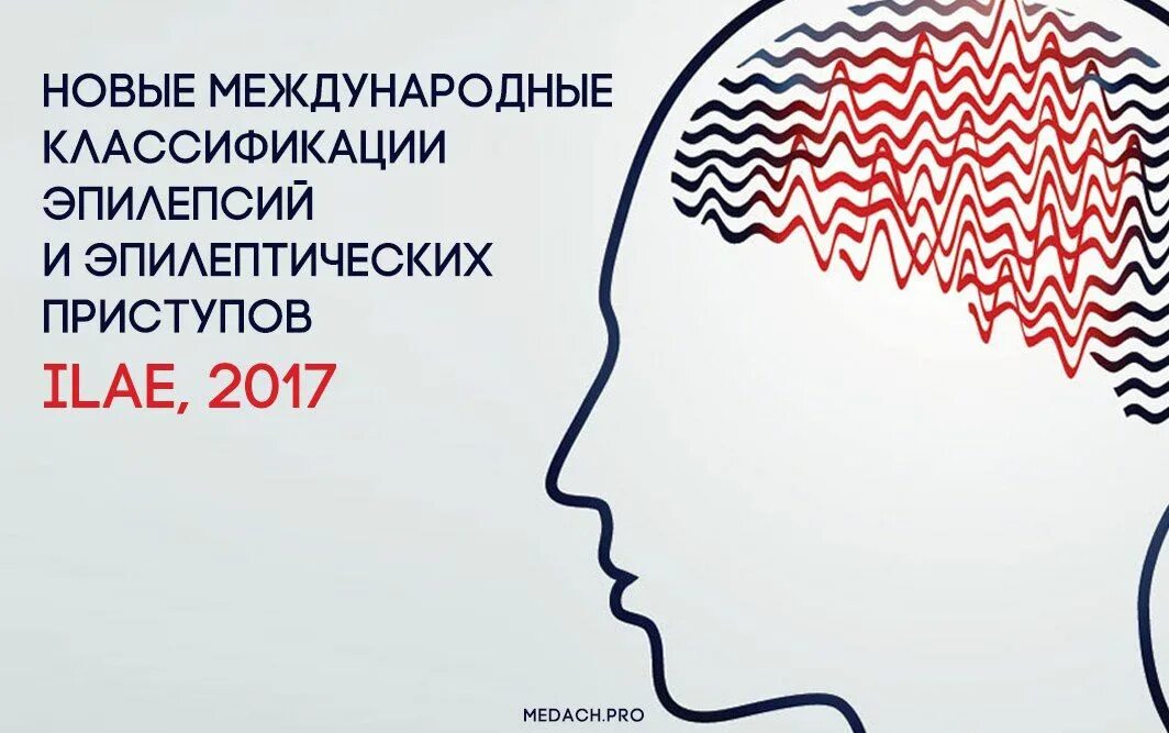 Классификация эпилептических приступов ILAE, 2017. Классификация эпилептический ILAE 2017. Классификация эпилепсии ILAE. Классификация эпилепсии новая. Нэо неврология эпилепсия остеопатия