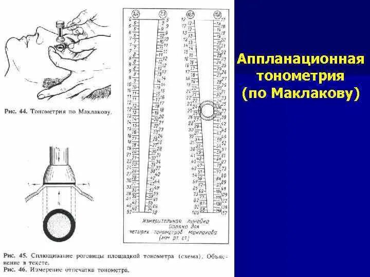 Внутриглазное давление по маклакову